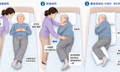 『附一科普』卧床老人如何翻身拍背？重点看这几个动作细节