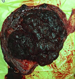 产房8分钟:一场生死时速的较量 产房8分钟:一场生死时速的较量