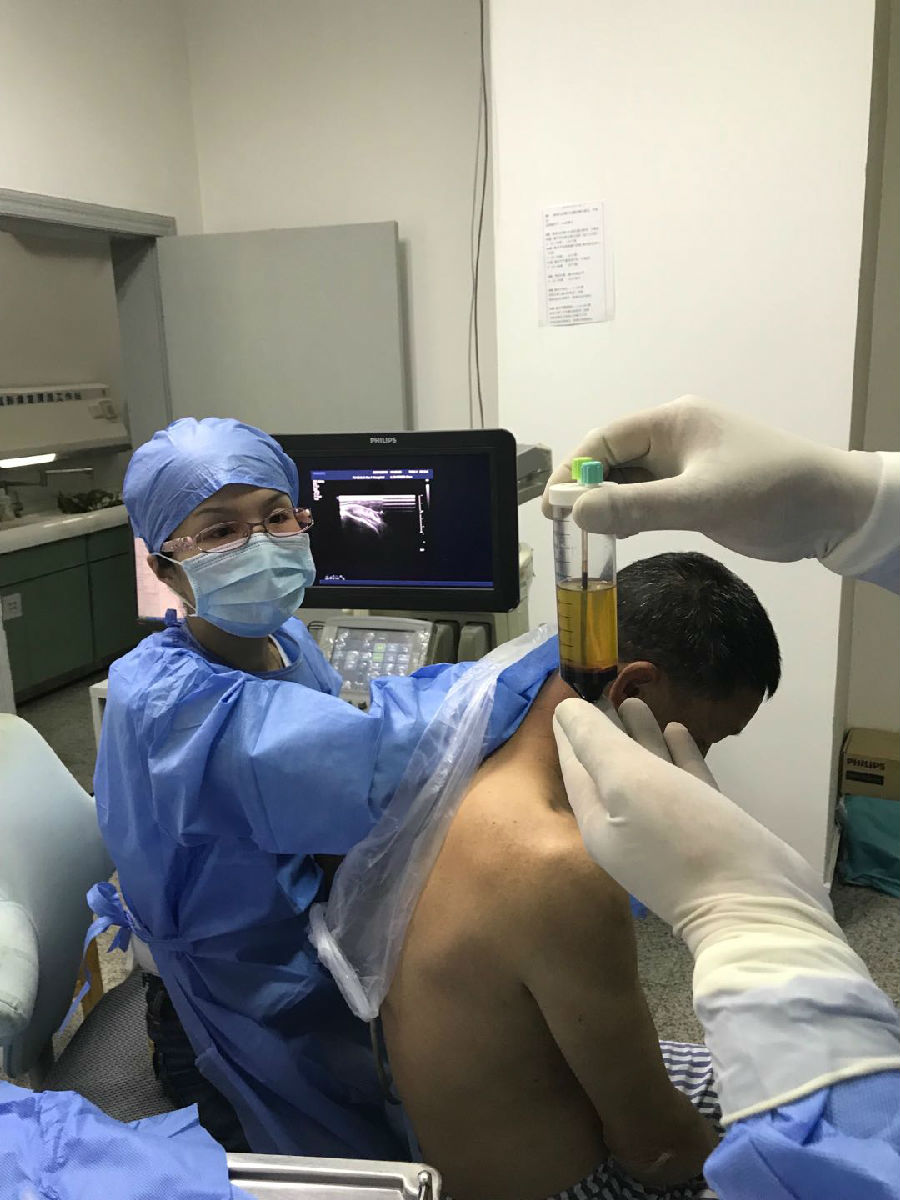 人体自带的神奇修复血浆PRP ——缓解关节疼痛,修复肌腱损伤,加速创面愈合 人体自带的神奇修复血浆PRP ——缓解关节疼痛,修复肌腱损伤,加速创面愈合