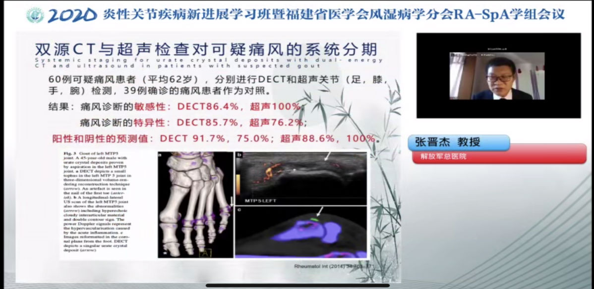 附一医院风湿免疫科举办2020炎性关节疾病新进展学习班