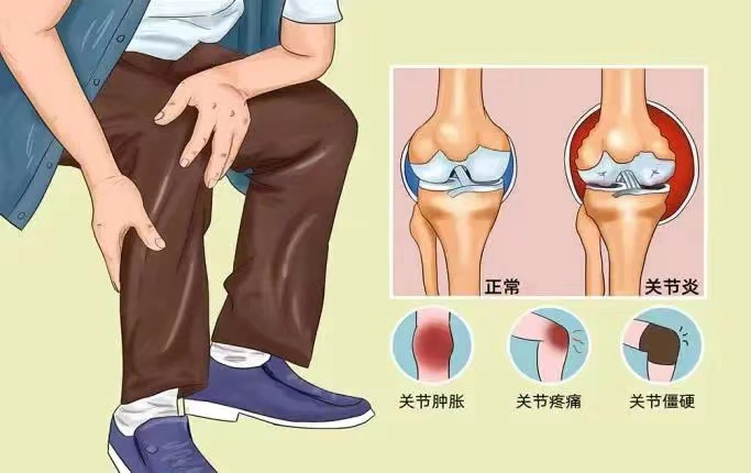 科普