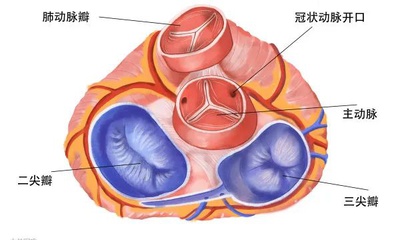 『附一医讯』一场小感冒，竟引发致命感染性心内膜炎！八旬老翁四扇“心门”全毁！我院心脏大血管外科勇闯高龄禁区，成功进行四瓣膜手术