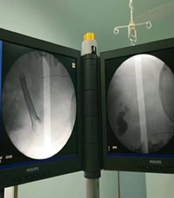 我院第六批援宁医疗队获“援固先进医疗队”荣誉称号高锐同志荣获“援固医疗队优秀队长”称号