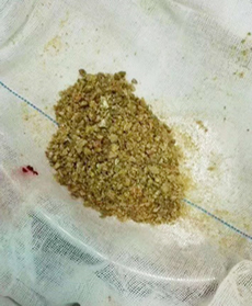 我院第六批援宁医疗队获“援固先进医疗队”荣誉称号高锐同志荣获“援固医疗队优秀队长”称号