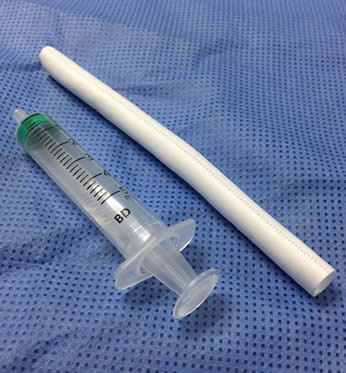 我院成功开展福建省首例颈动脉侵犯的喉恶性肿瘤动脉重建术