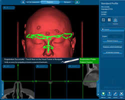 我院耳鼻咽喉科引进国际最先进的专科电磁导航系统助力精准耳鼻颅底手术