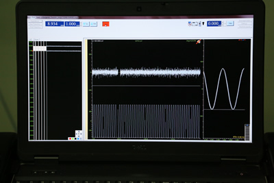 福建首台、全国第六台ROSA机器人落户附一医院,已成功连续开展手术 福建首台、全国第六台ROSA机器人落户附一医院,已成功连续开展手术