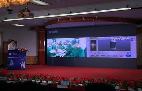 我院举行福建首台脊柱手术机器人开机仪式暨现场手术直播——目前已顺利开展全国首例高位胸椎畸形矫正手术