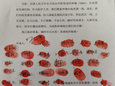 『附一抗疫』守护生命，抗击疫情
——急诊科战“疫”事记